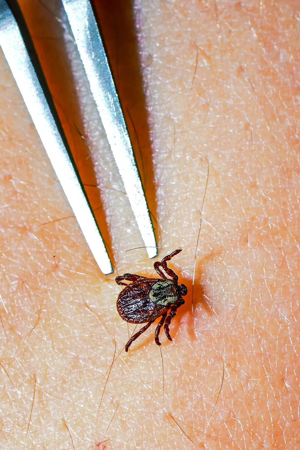 Ticks & Mites Control